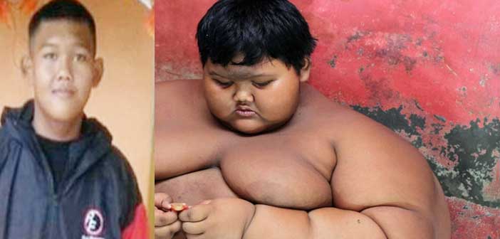 ৮৭ কেজি ওজন কমালো কিশোর